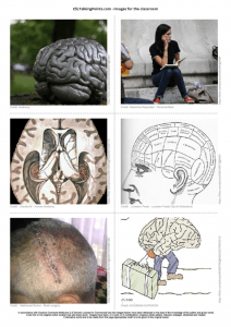 thumbnail of Images for class brains